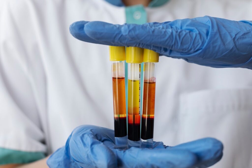 Rwanda’s Strategic Initiative to Export Human Plasma