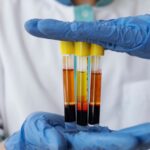 Rwanda’s Strategic Initiative to Export Human Plasma